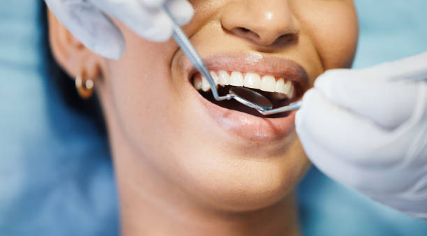 Best Emergency Dental Care for Broken or Chipped Teeth in Dunnavant, AL