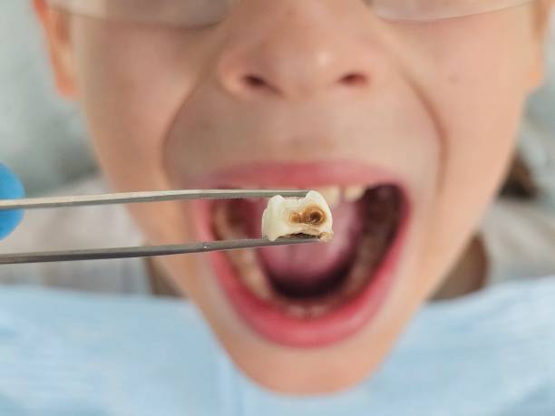 Best Emergency Denture Repair in Dunnavant, AL