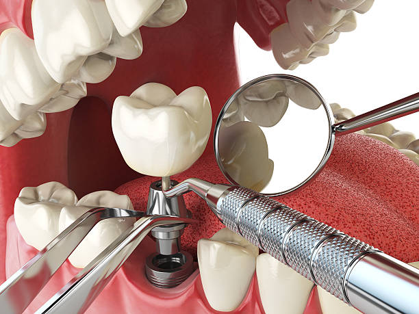 Best Cosmetic Emergency Dentistry in Dunnavant, AL